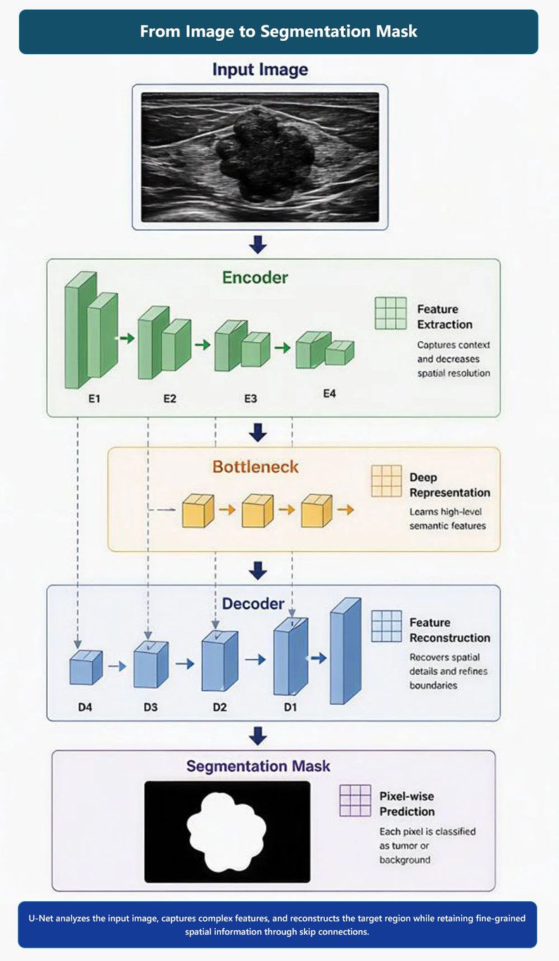 Why U-Net Is Widely Used for Medical Image Segmentation